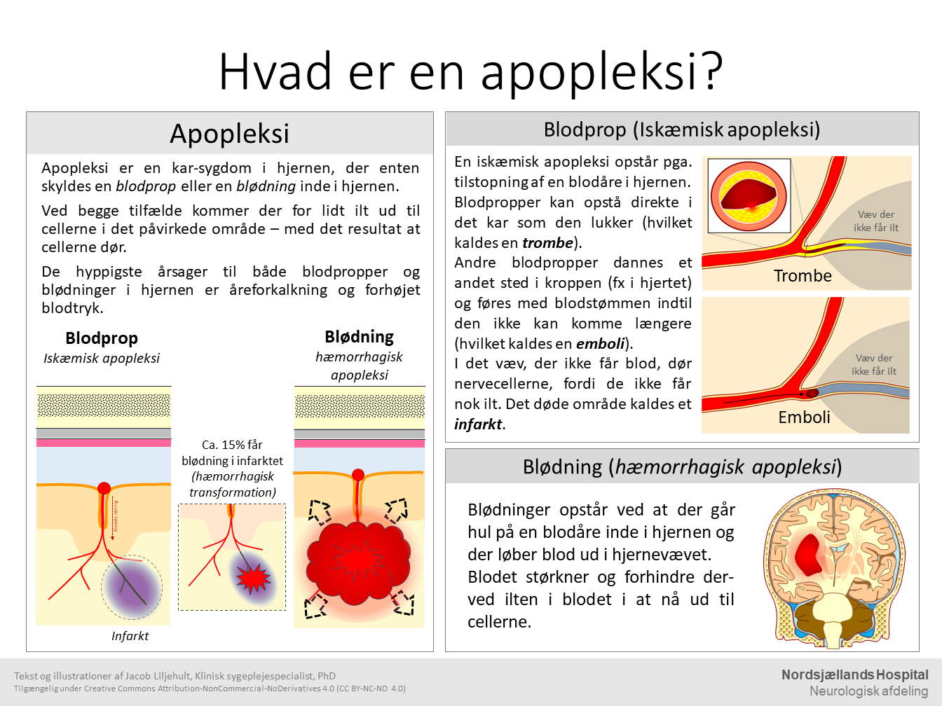 Hvad er en apopleksi