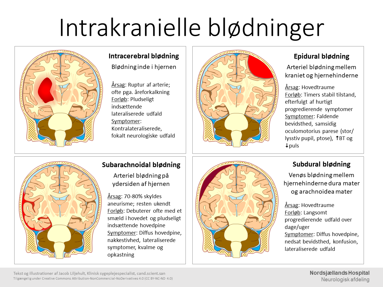 Intrakranielle blødninger