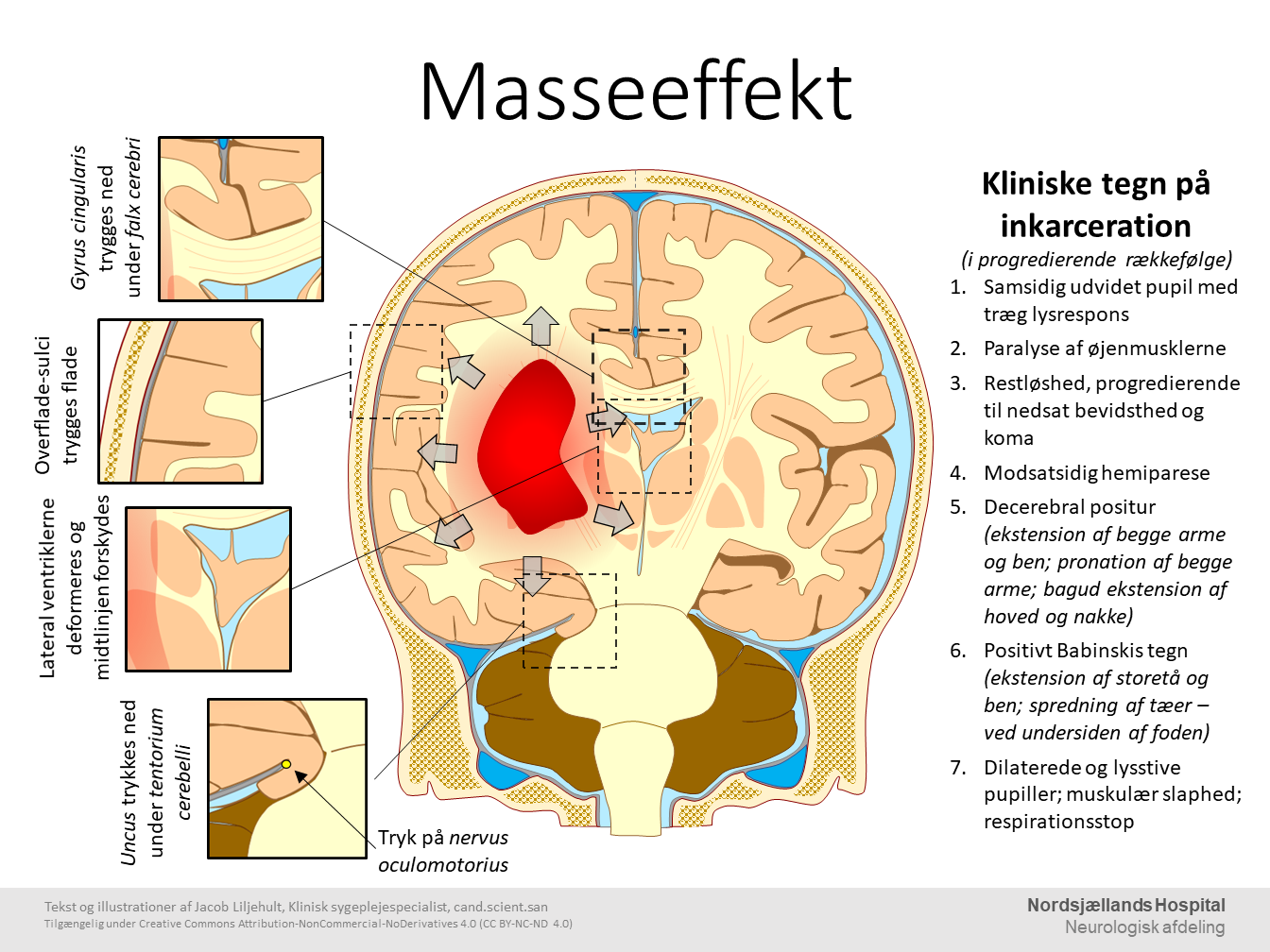 Masseeffekt