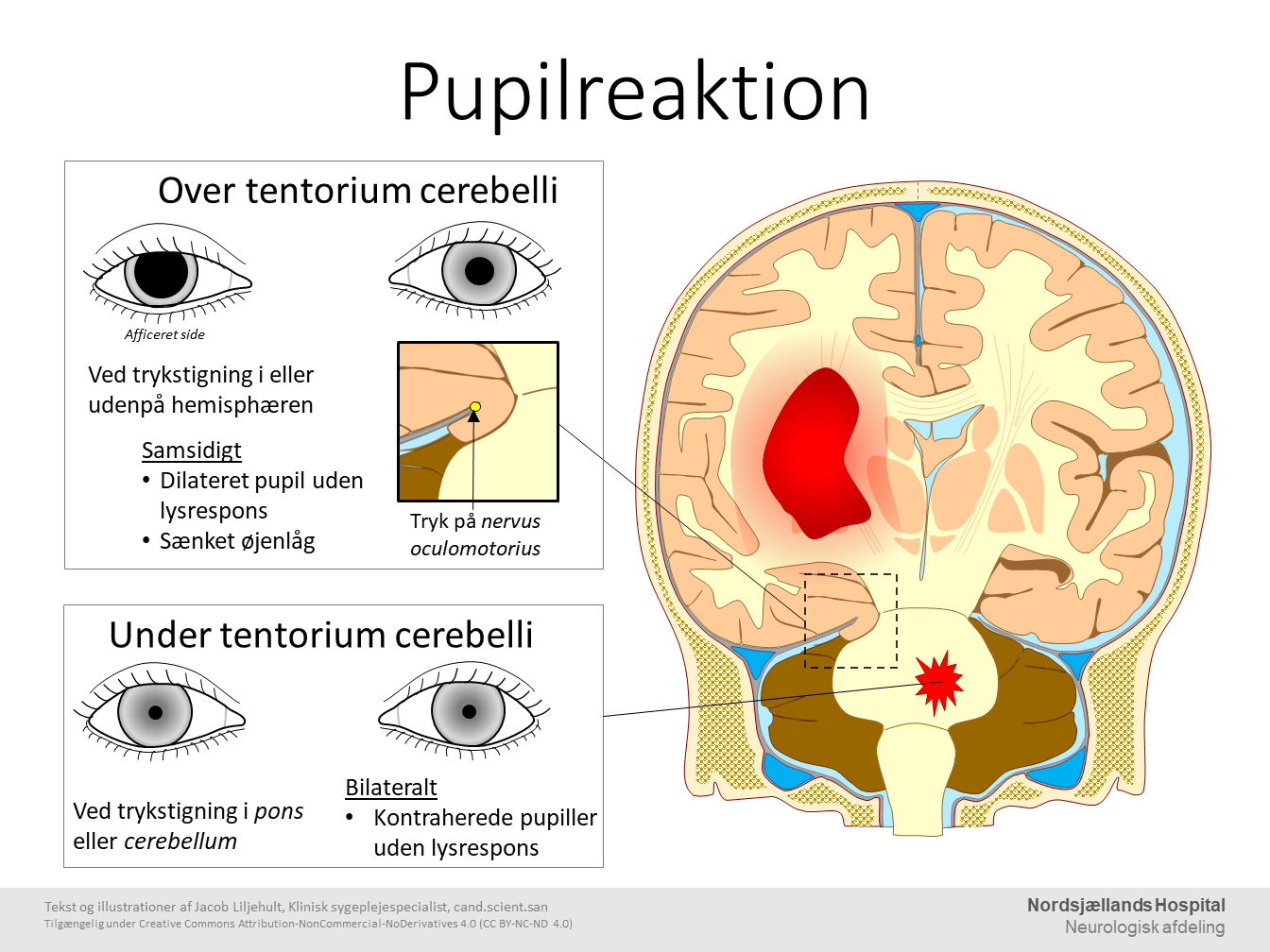 Pupilreaktion